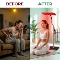 660Nm 850Nm LED Red Light Therapy Panel with Stand near Infrared Therapy Lamp Devices for Body Muscle Relax and Skin Care — Before & After